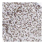 Atlas Antibodies Anti-ZNF544 Antibody