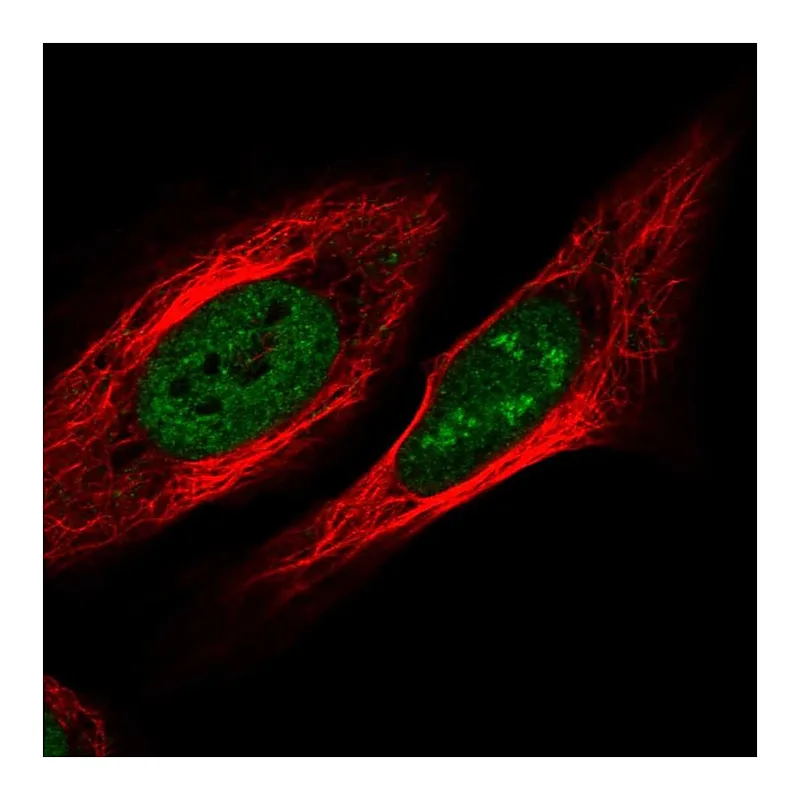 Atlas Antibodies Anti-ZNF554 Antibody