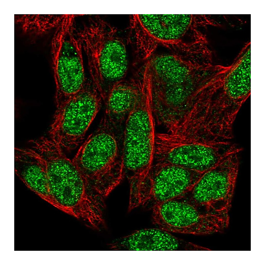 Atlas Antibodies Anti-ZNF556 Antibody