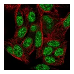 Atlas Antibodies Anti-ZNF556 Antibody