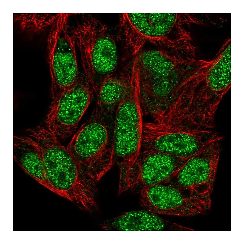 Atlas Antibodies Anti-ZNF556 Antibody