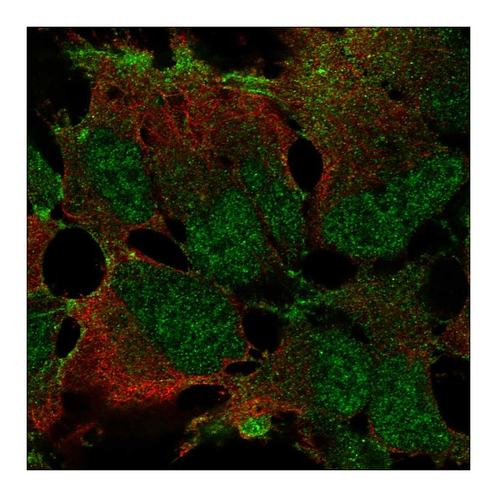 Atlas Antibodies Anti-ZNF560 Antibody
