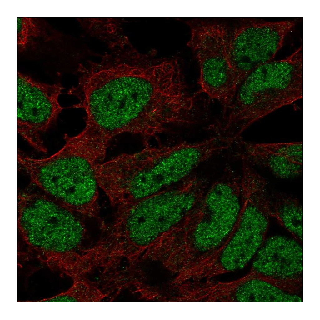 Atlas Antibodies Anti-ZNF560 Antibody