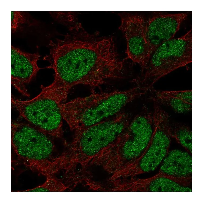 Atlas Antibodies Anti-ZNF560 Antibody
