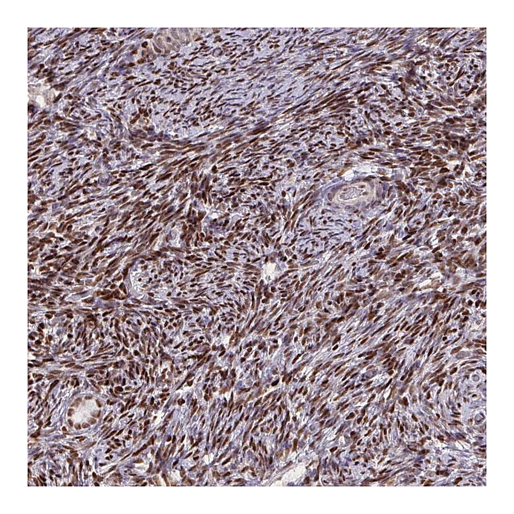Atlas Antibodies Anti-ZNF559 Antibody