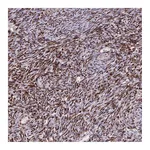 Atlas Antibodies Anti-ZNF559 Antibody