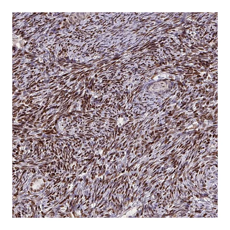 Atlas Antibodies Anti-ZNF559 Antibody