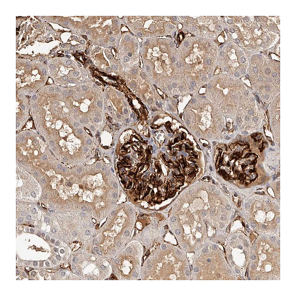 Atlas Antibodies Anti-ZNF557 Antibody