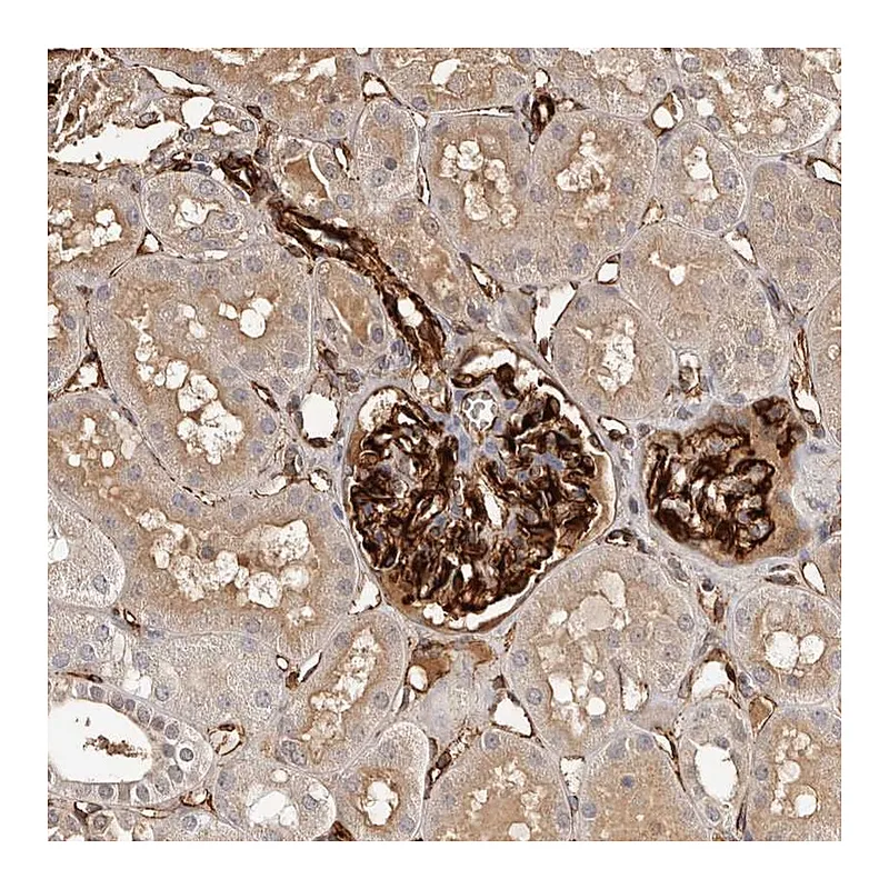 Atlas Antibodies Anti-ZNF557 Antibody