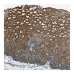 Atlas Antibodies Anti-ZNF558 Antibody