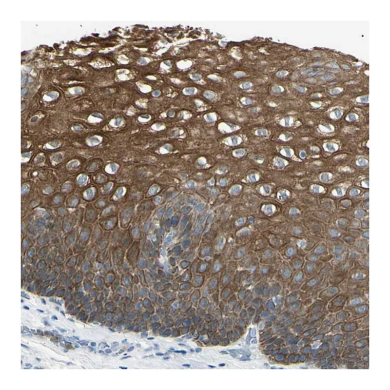 Atlas Antibodies Anti-ZNF558 Antibody