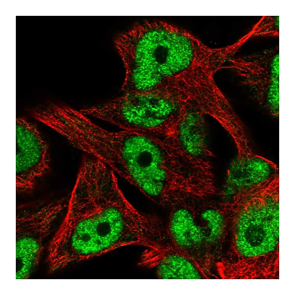Atlas Antibodies Anti-ZNF559 Antibody