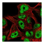 Atlas Antibodies Anti-ZNF559 Antibody