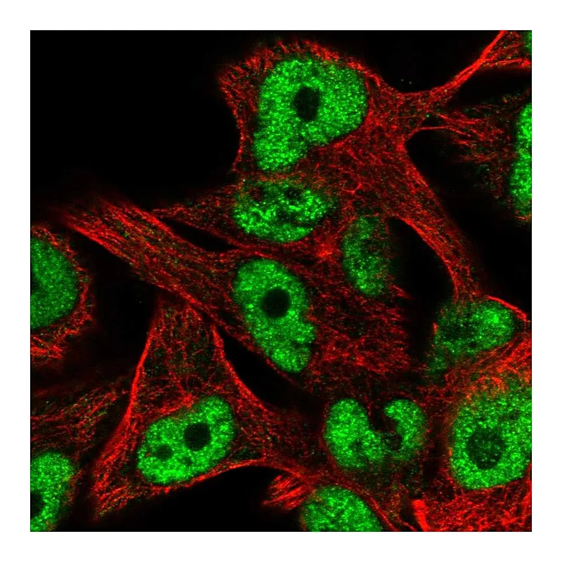 Atlas Antibodies Anti-ZNF559 Antibody