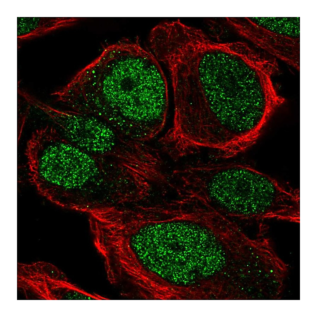 Atlas Antibodies Anti-ZNF561 Antibody