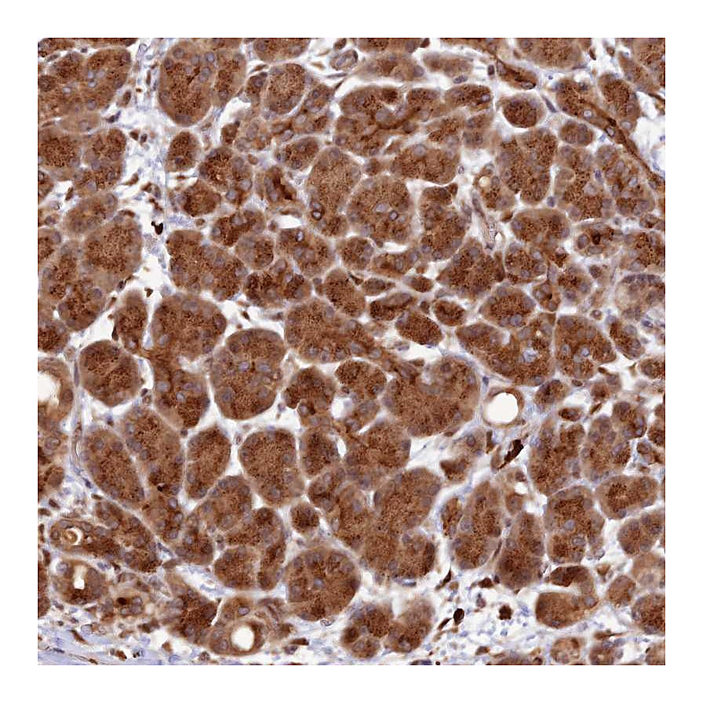 Atlas Antibodies Anti-ZNF565 Antibody