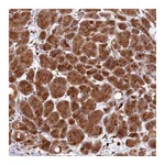 Atlas Antibodies Anti-ZNF565 Antibody