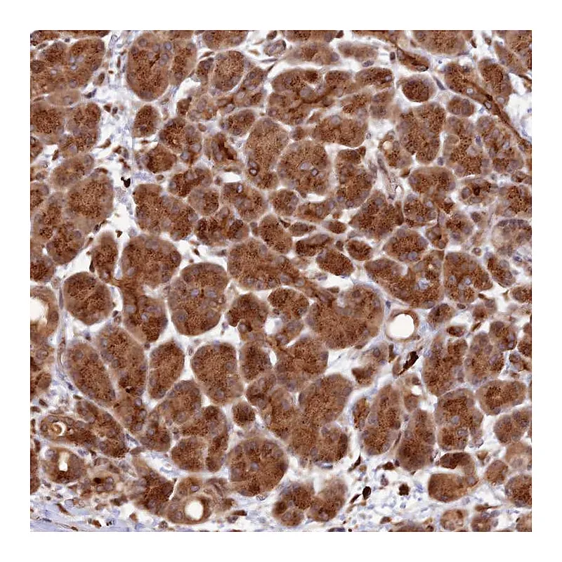 Atlas Antibodies Anti-ZNF565 Antibody