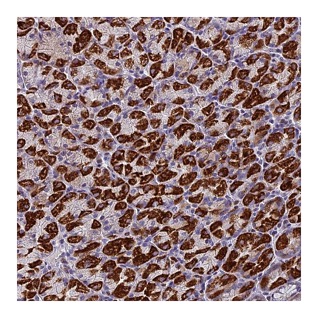 Atlas Antibodies Anti-ZNF563 Antibody