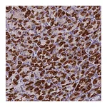 Atlas Antibodies Anti-ZNF563 Antibody