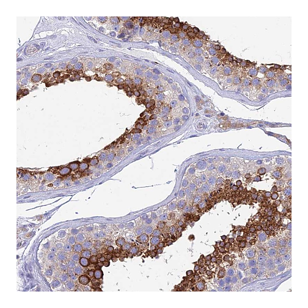 Atlas Antibodies Anti-ZNF564 Antibody