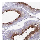Atlas Antibodies Anti-ZNF564 Antibody