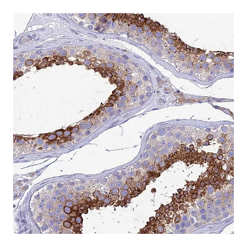 Atlas Antibodies Anti-ZNF564 Antibody