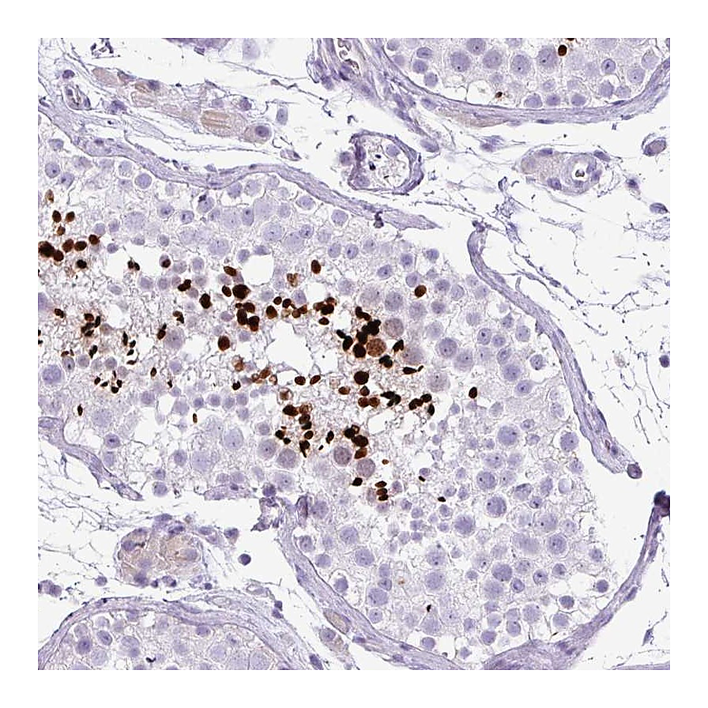 Atlas Antibodies Anti-ZNF568 Antibody