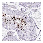 Atlas Antibodies Anti-ZNF568 Antibody