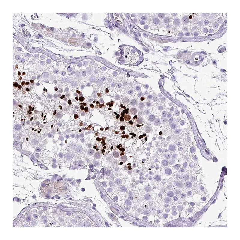 Atlas Antibodies Anti-ZNF568 Antibody
