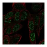 Atlas Antibodies Anti-ZNF568 Antibody