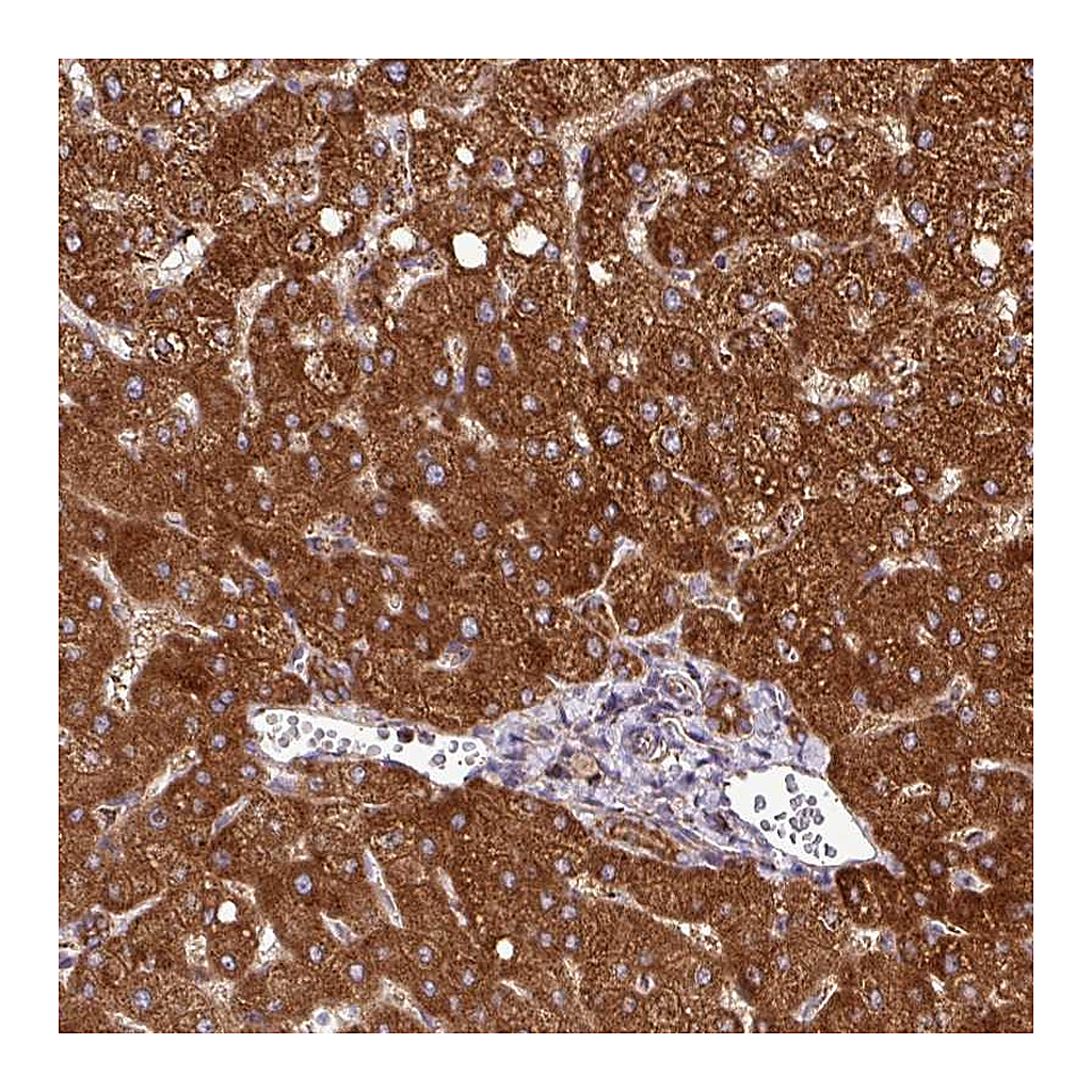 Atlas Antibodies Anti-ZNF569 Antibody