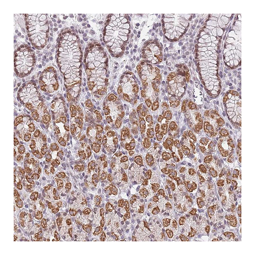 Atlas Antibodies Anti-ZNF574 Antibody