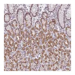 Atlas Antibodies Anti-ZNF574 Antibody