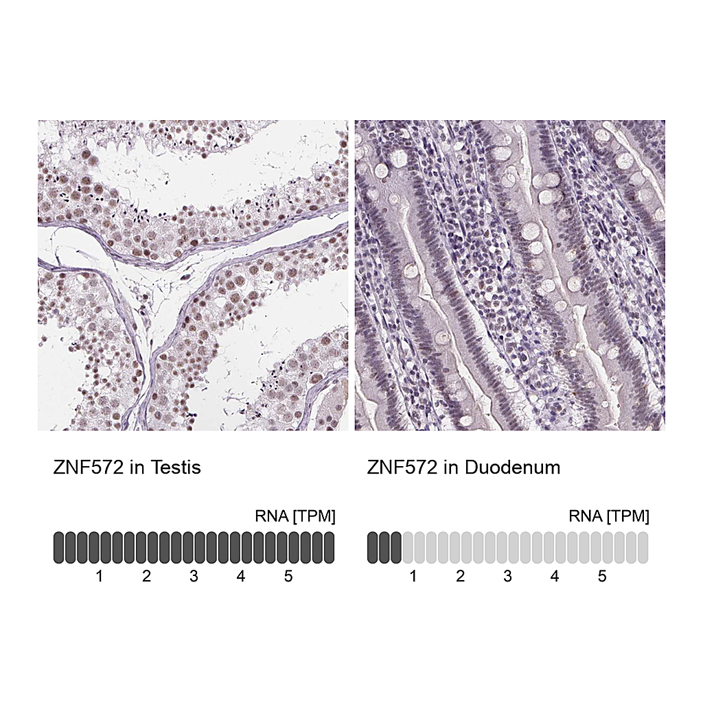 Atlas Antibodies Anti-ZNF572 Antibody