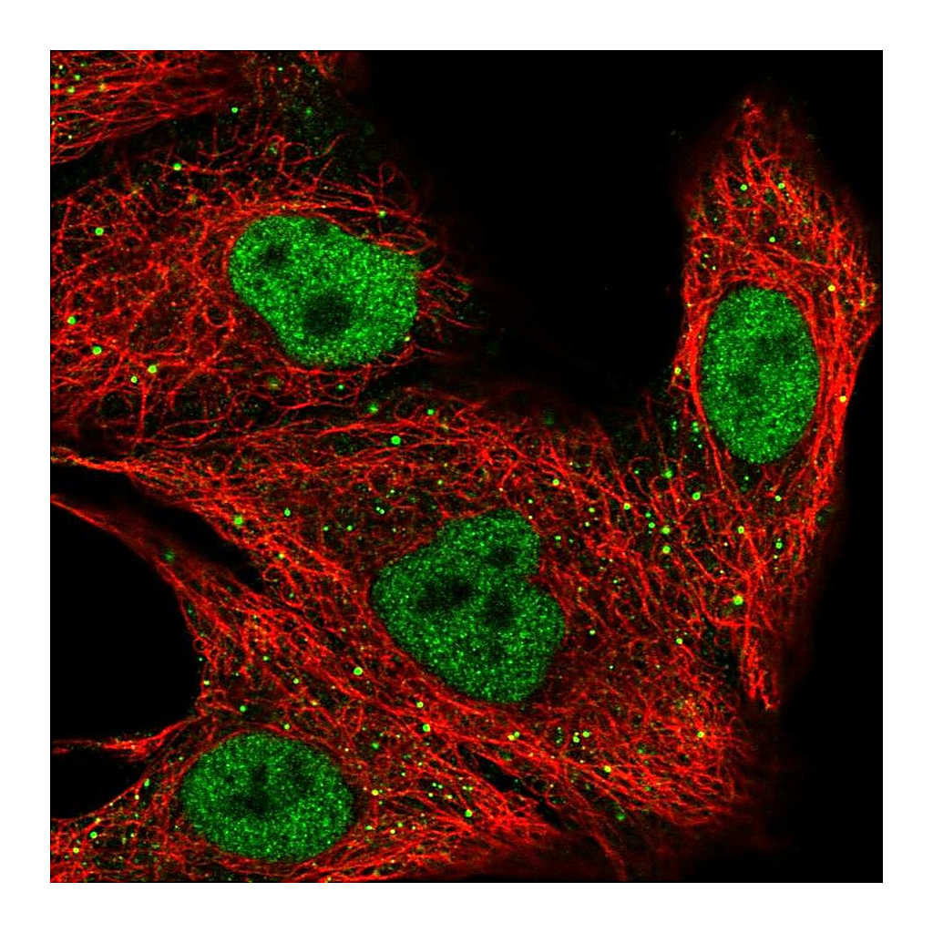 Atlas Antibodies Anti-ZNF574 Antibody