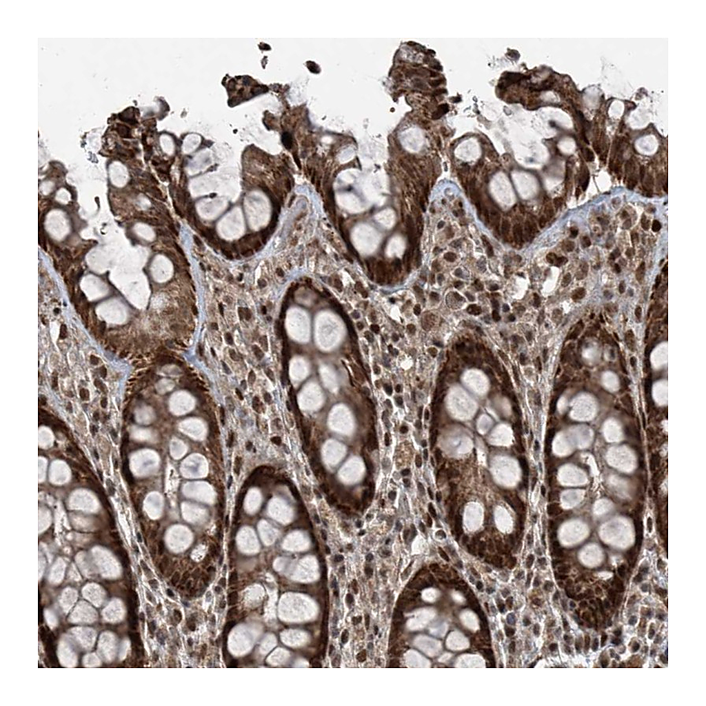 Atlas Antibodies Anti-ZNF570 Antibody