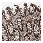 Atlas Antibodies Anti-ZNF570 Antibody