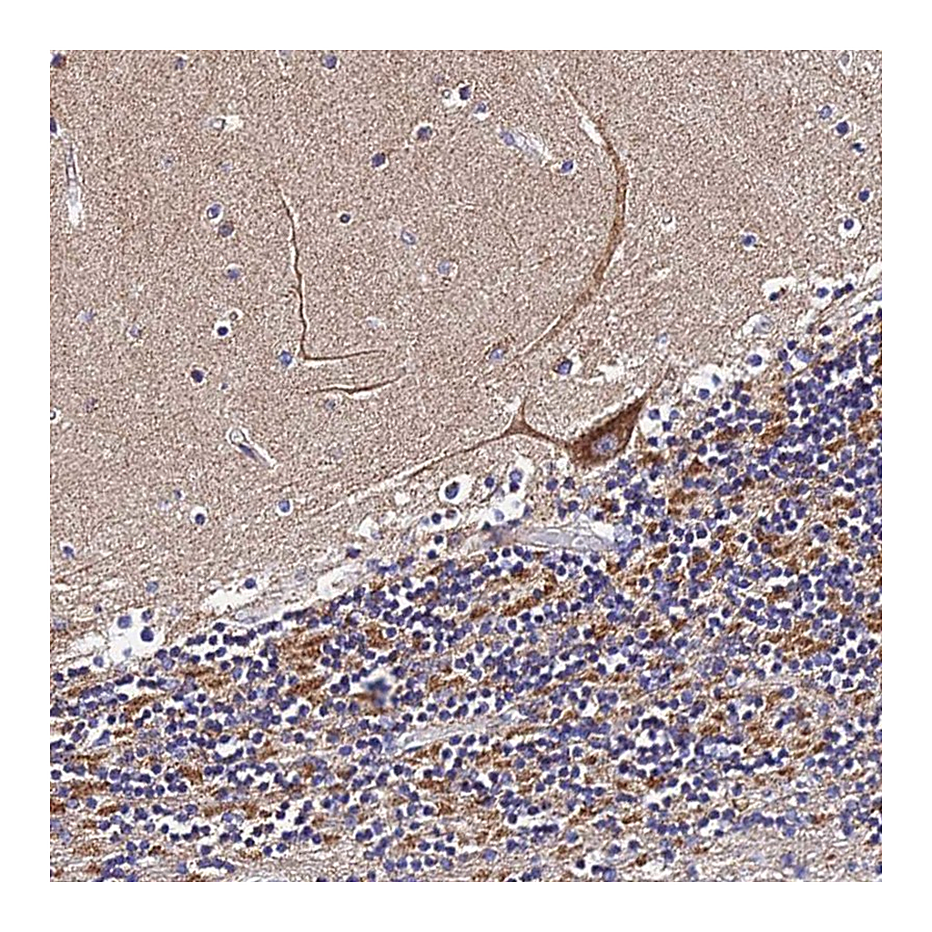Atlas Antibodies Anti-ZNF573 Antibody