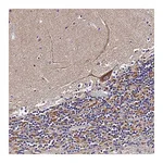 Atlas Antibodies Anti-ZNF573 Antibody