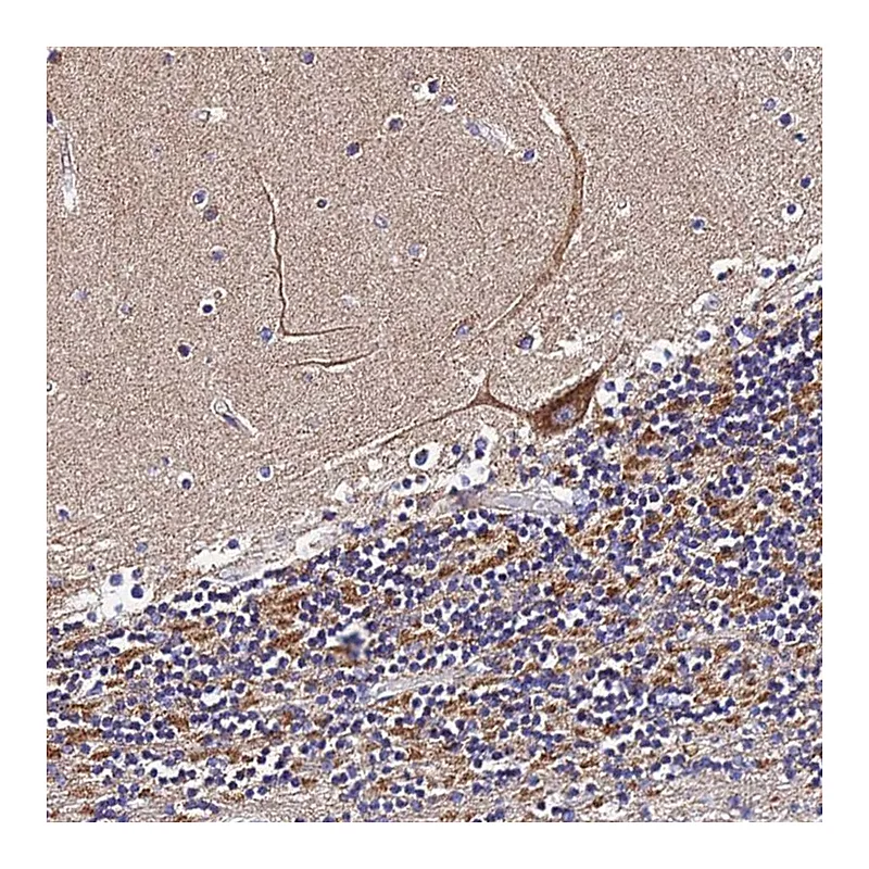 Atlas Antibodies Anti-ZNF573 Antibody