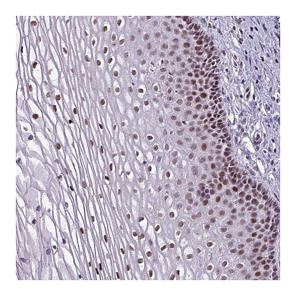 Atlas Antibodies Anti-ZNF575 Antibody