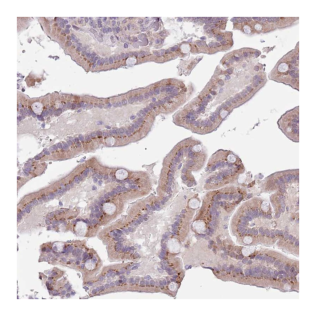 Atlas Antibodies Anti-ZNF576 Antibody