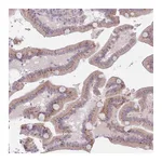 Atlas Antibodies Anti-ZNF576 Antibody
