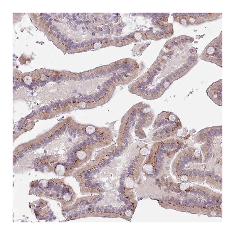 Atlas Antibodies Anti-ZNF576 Antibody