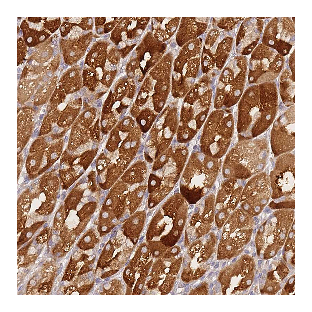 Atlas Antibodies Anti-ZNF577 Antibody