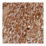 Atlas Antibodies Anti-ZNF577 Antibody