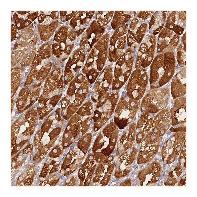 Atlas Antibodies Anti-ZNF577 Antibody