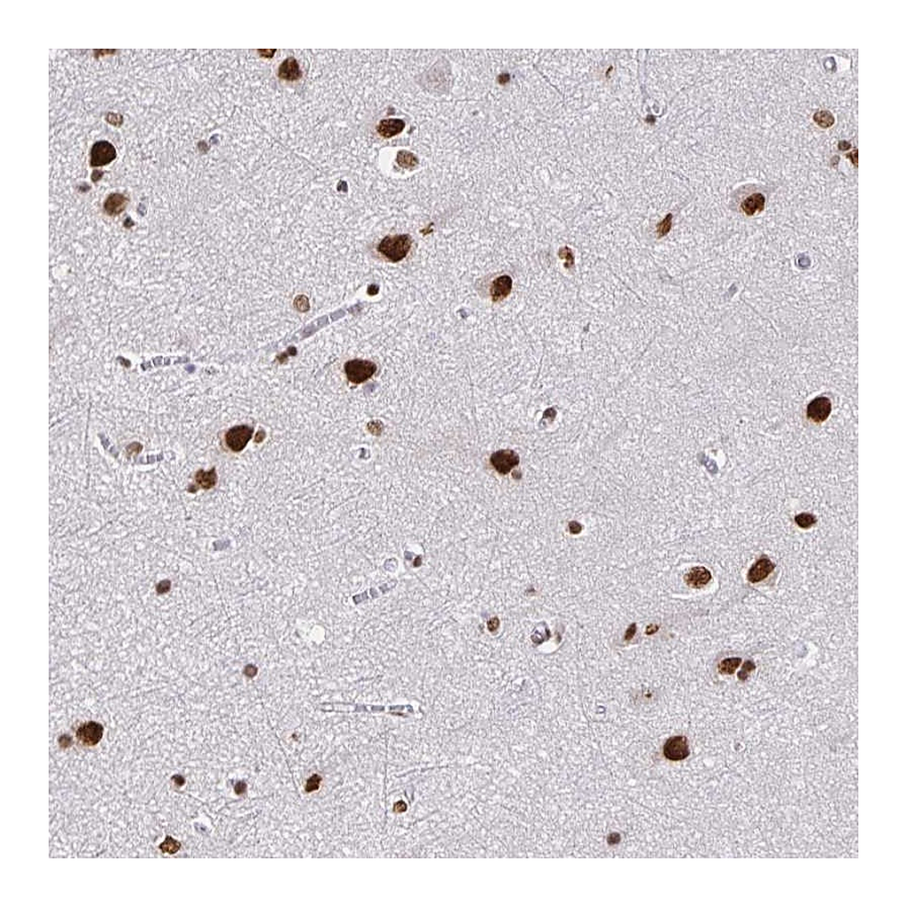 Atlas Antibodies Anti-ZNF579 Antibody