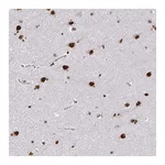 Atlas Antibodies Anti-ZNF579 Antibody